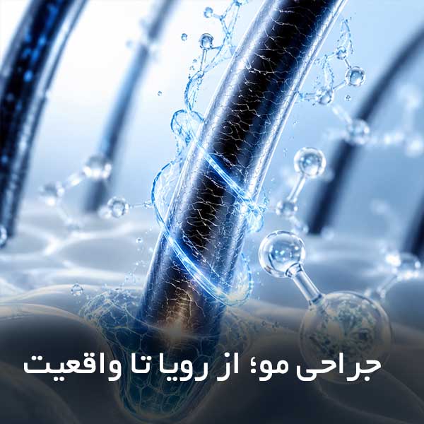 جراحی مو