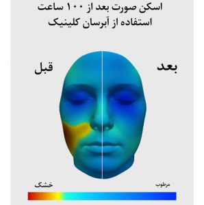 کرم آبرسان صد ساعته کلینیک اصل